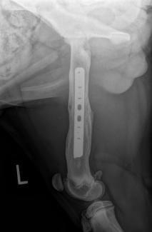 Femoral fracture repair healed